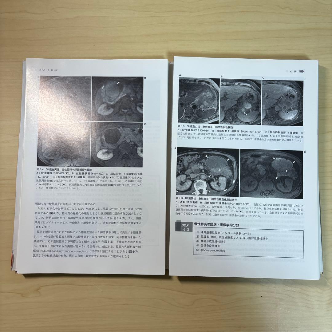 腹部のMRI