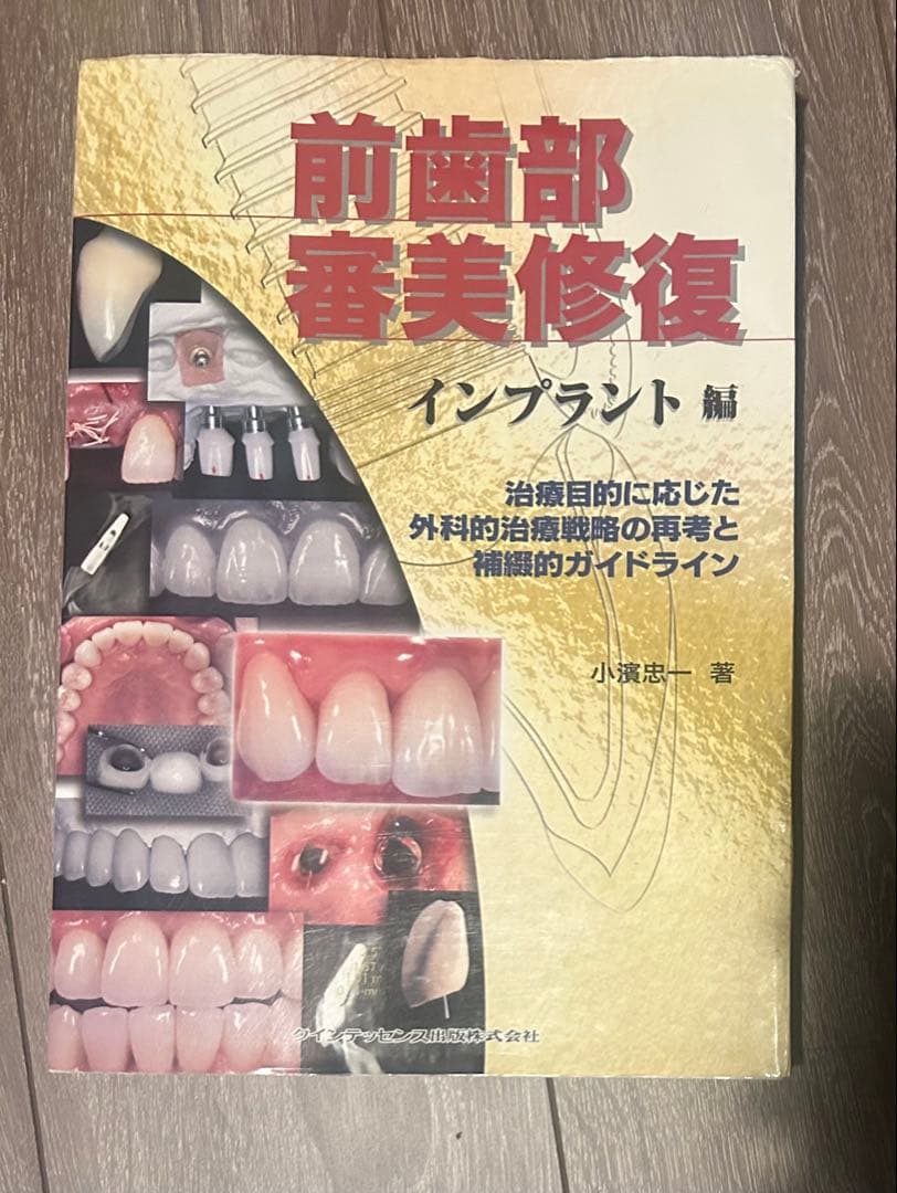 前歯部審美修復 インプラント編　(裁断されていません)